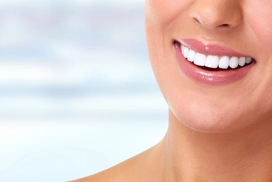 A woman with white teeth smiling for the camera.