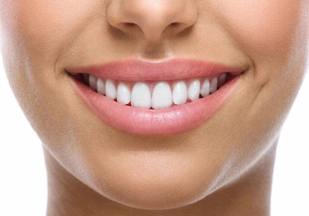 A woman with white teeth smiling for the camera.